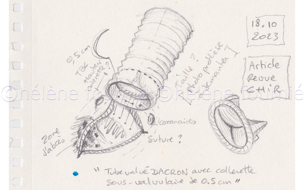 Cardiologie-illustration-trait