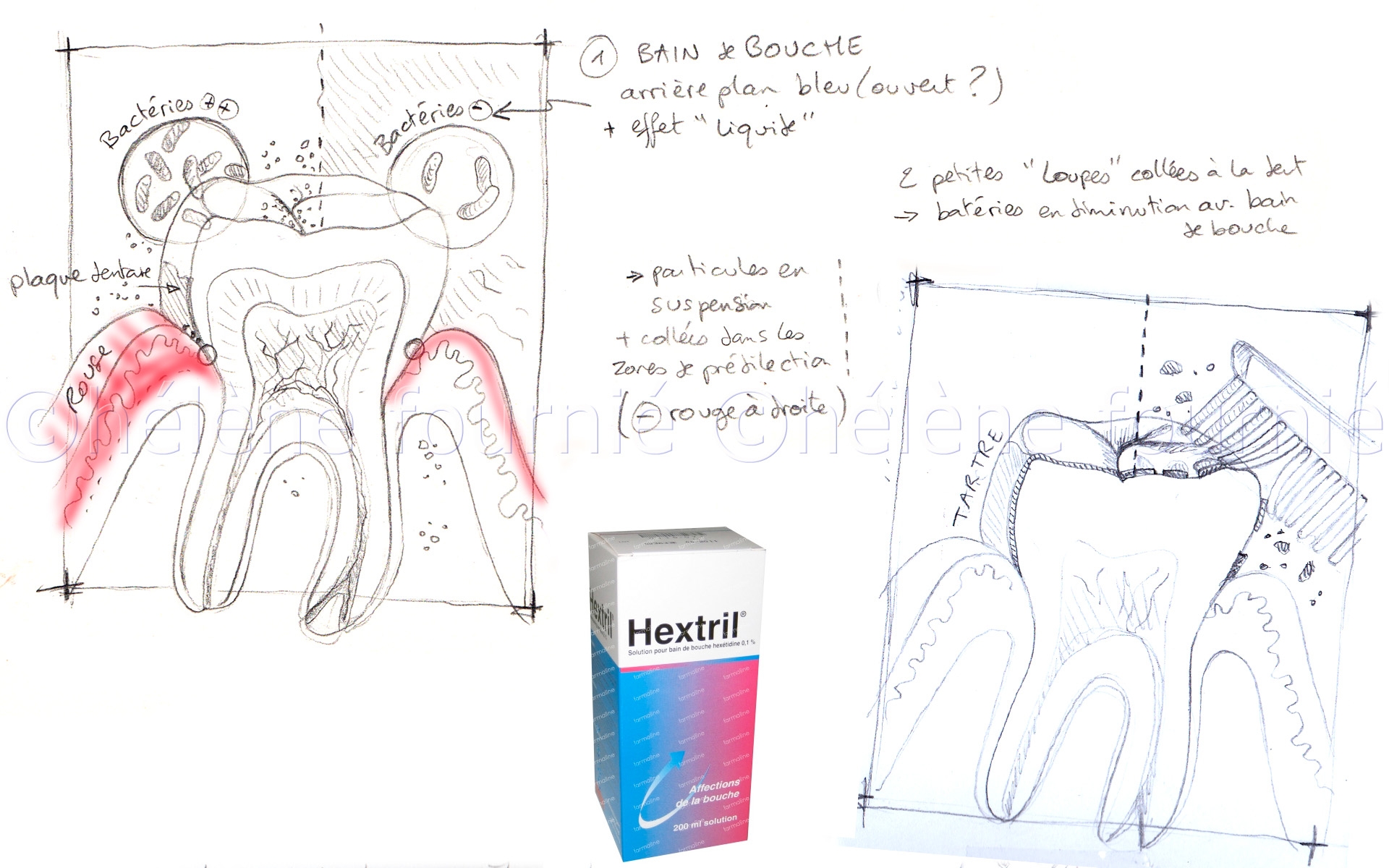 Hextril-solution-dentaire