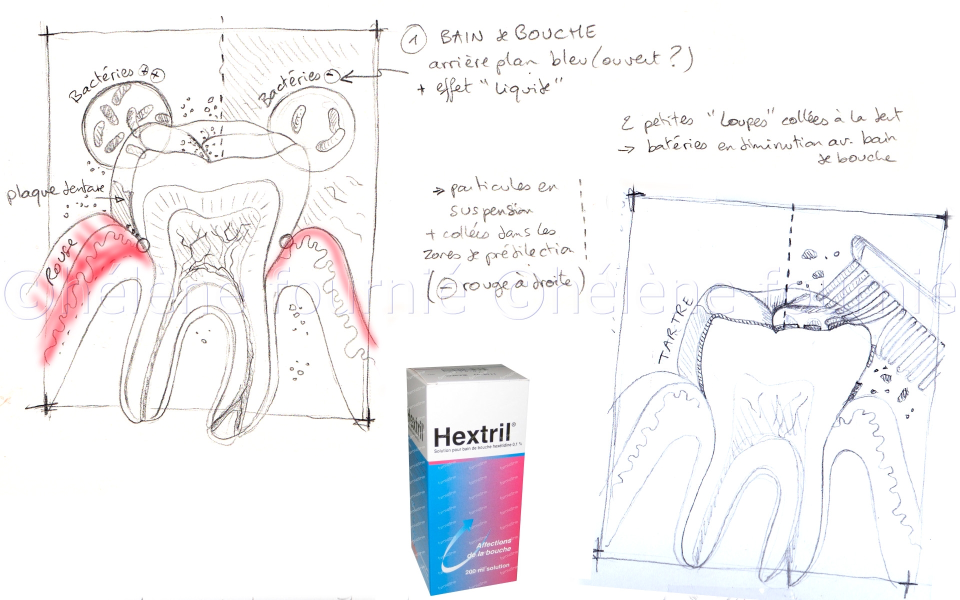 Hextril-dental-treatment