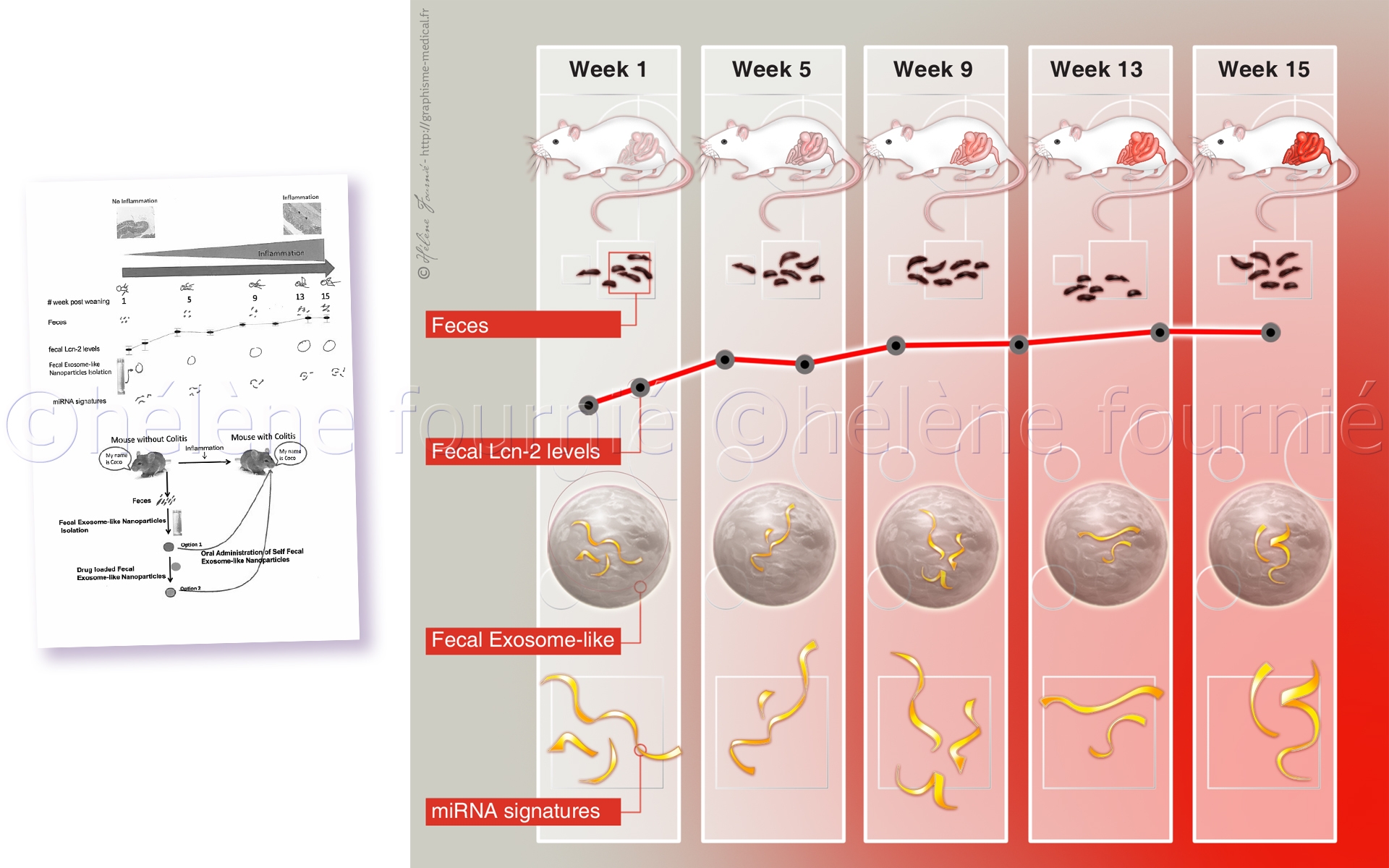 colitis-GSU