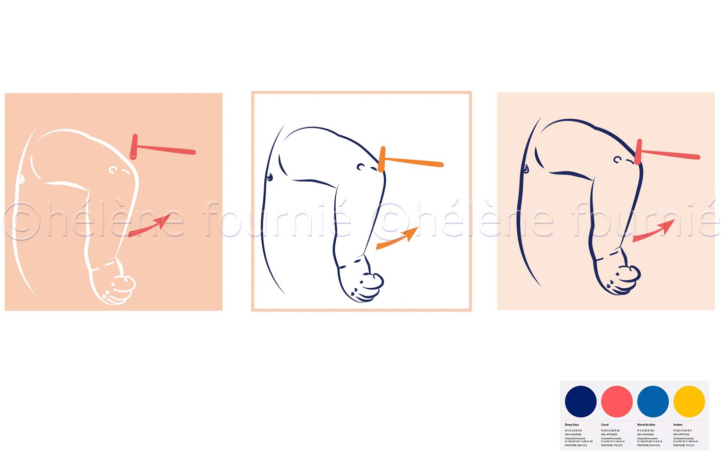 ChirurgieCou-helene-fournie-1