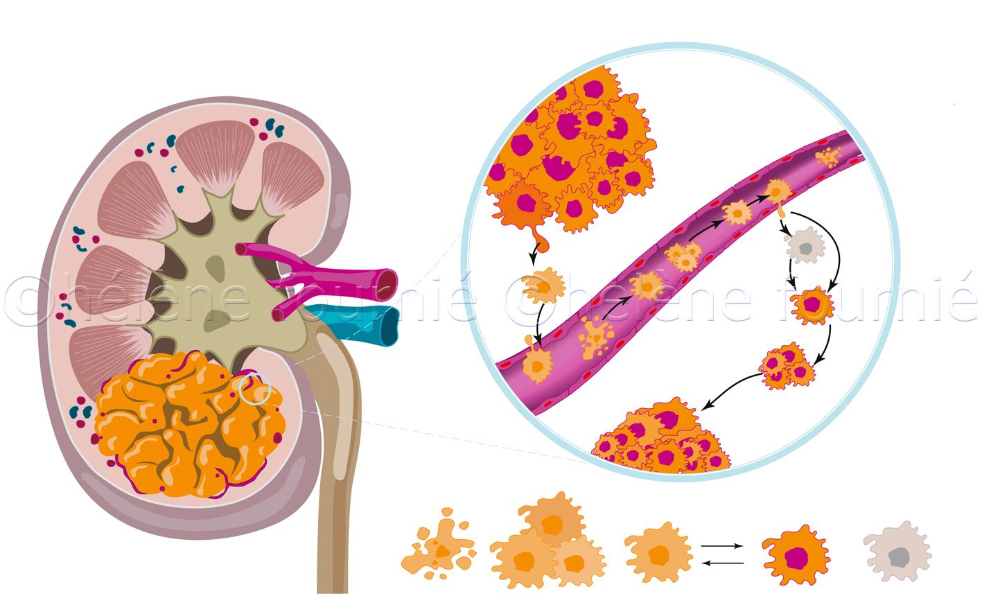 ChirurgieCou-helene-fournie-2