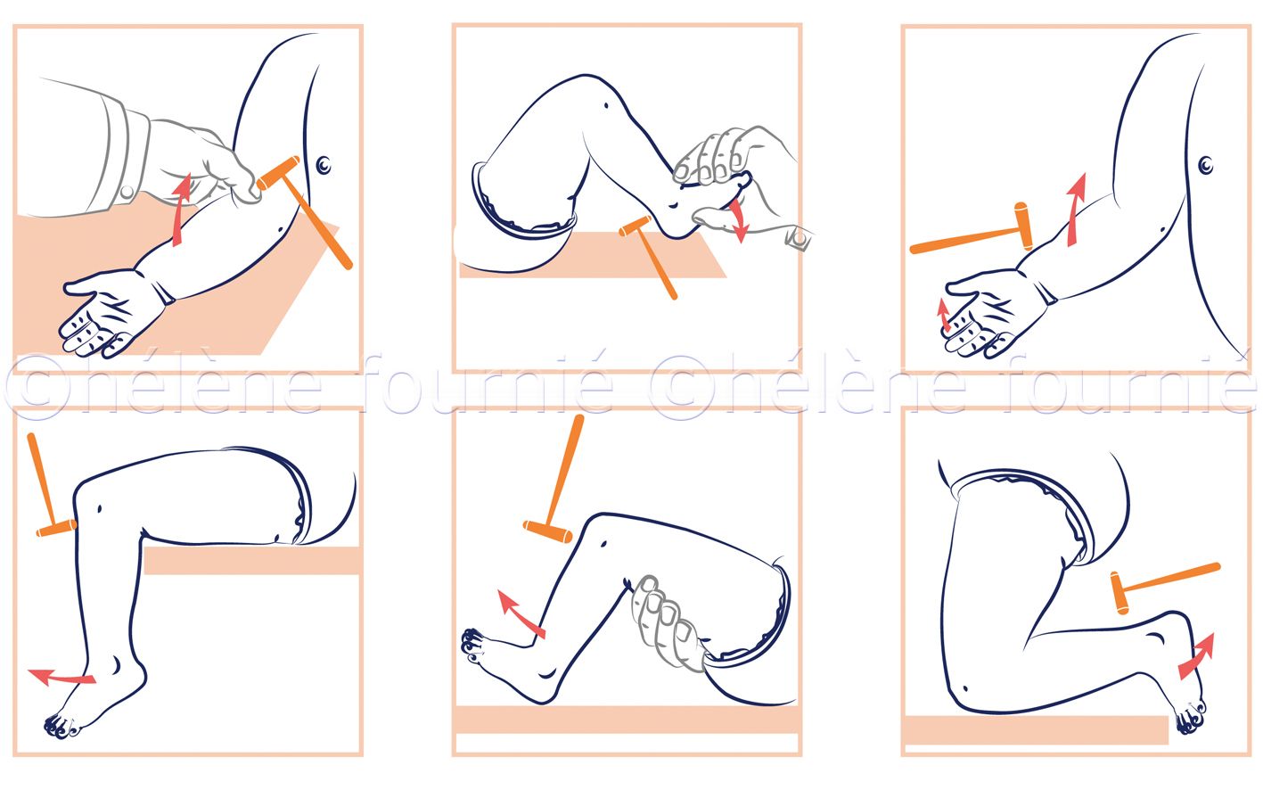 ChirurgieCou-helene-fournie-3